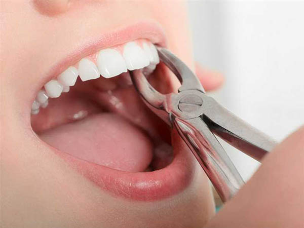 Tooth Extraction Dentist Whitehall Montana Dennis Sacry Dental